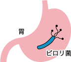 胃 ピロリ菌